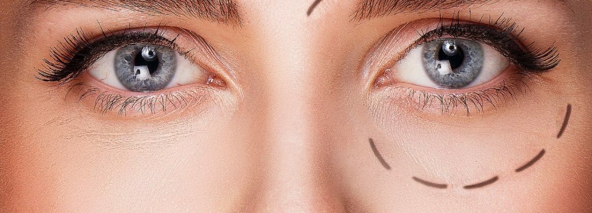 Chirurgie plastique paupières Clinique Ophtalmologique Tunis